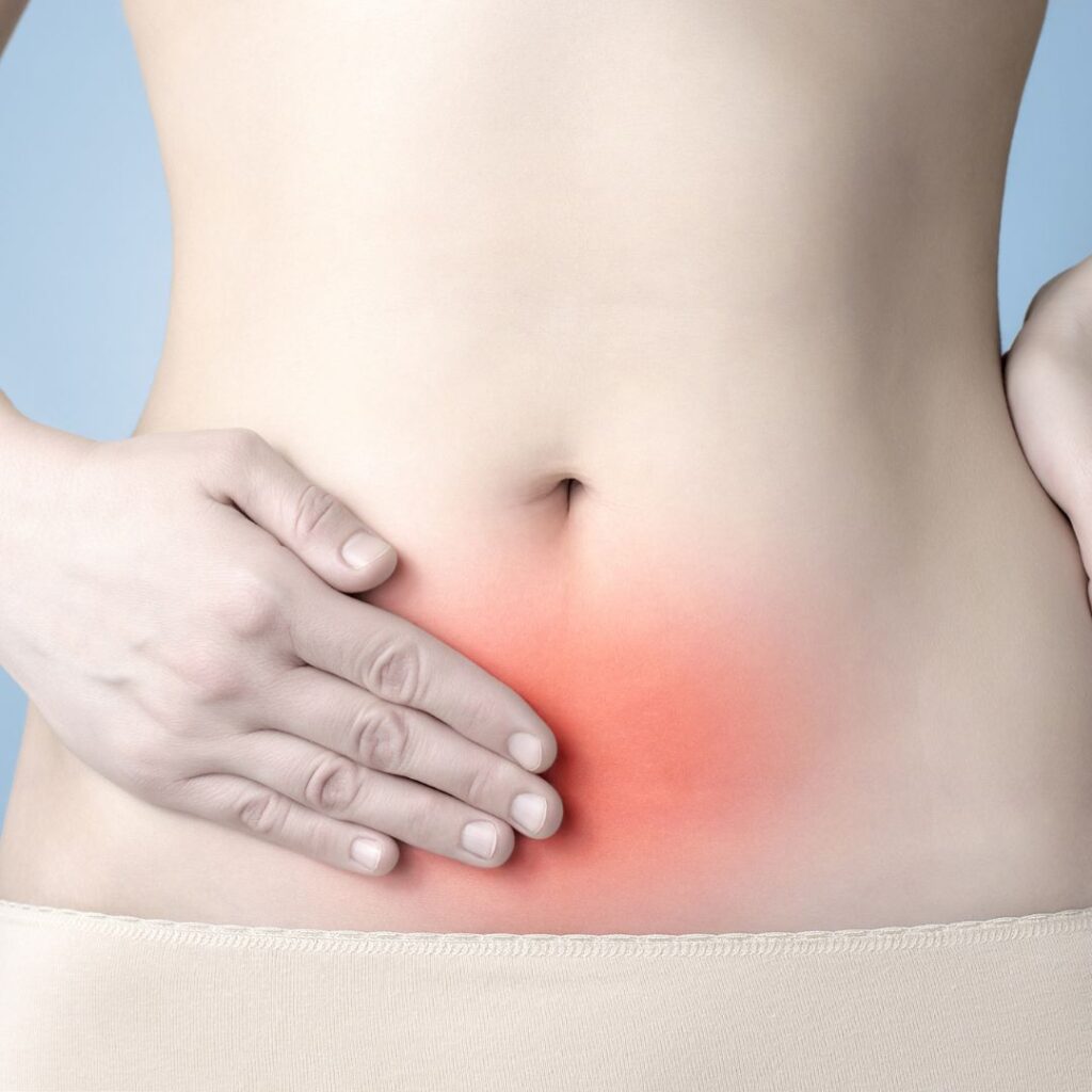 Endometriose: causas x sintomas